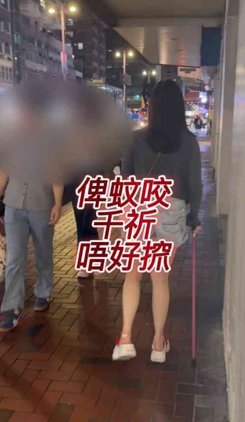 細菌感染︱港女腳眼被蚊咬「小蚊爛」變蜂窩性組織炎　急速惡化腫如網球