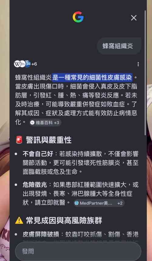 細菌感染︱港女腳眼被蚊咬「小蚊爛」變蜂窩性組織炎　急速惡化腫如網球