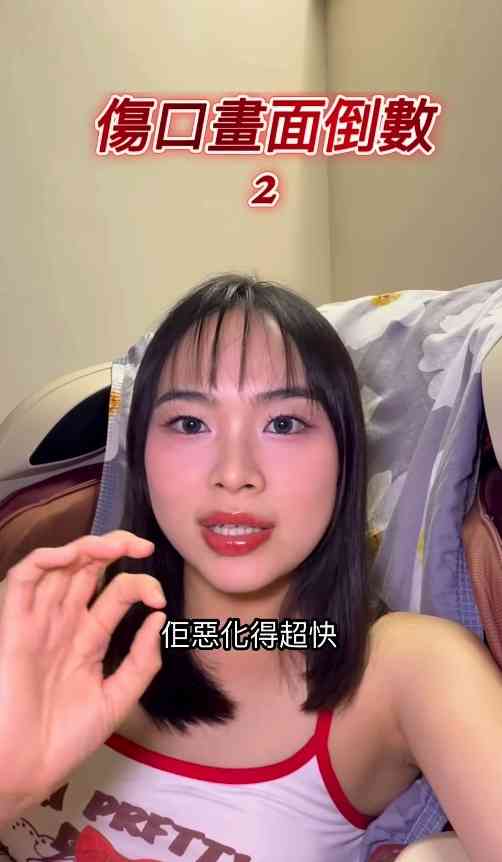細菌感染︱港女腳眼被蚊咬「小蚊爛」變蜂窩性組織炎　急速惡化腫如網球