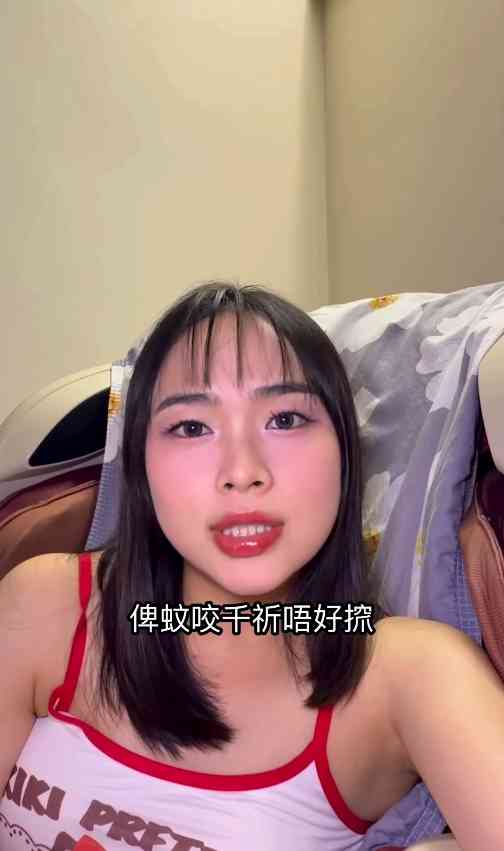 細菌感染︱港女腳眼被蚊咬「小蚊爛」變蜂窩性組織炎　急速惡化腫如網球