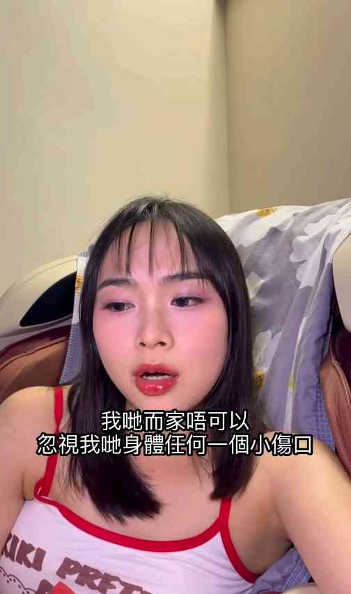 細菌感染︱港女腳眼被蚊咬「小蚊爛」變蜂窩性組織炎　急速惡化腫如網球