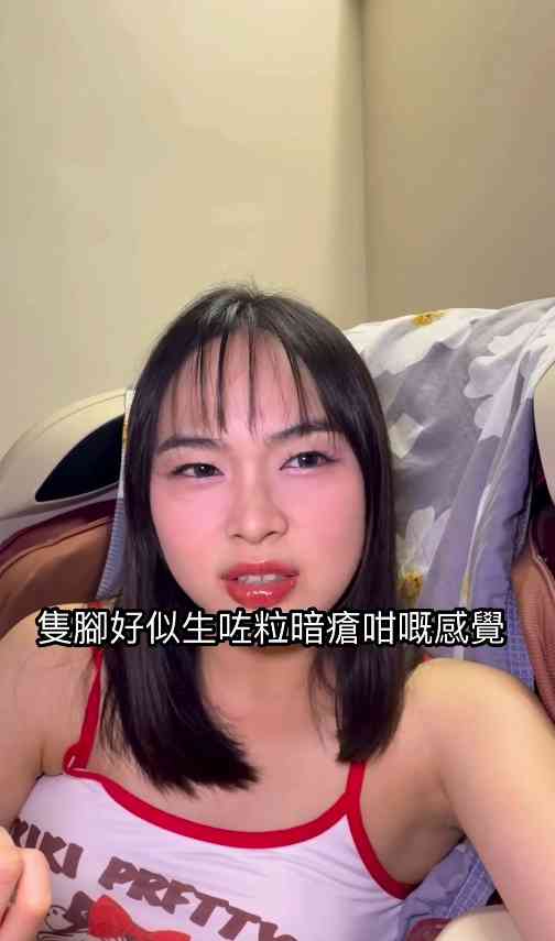 細菌感染︱港女腳眼被蚊咬「小蚊爛」變蜂窩性組織炎　急速惡化腫如網球