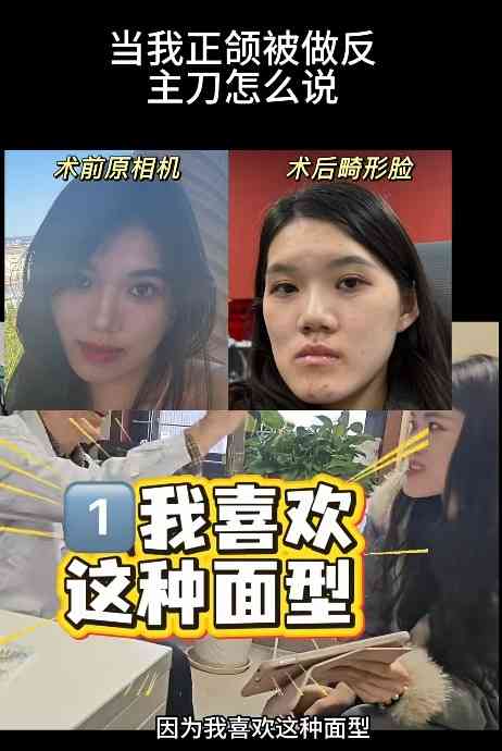 正顎手術丨24歲女做正顎手術反變「鞋抽面」 　醫生死撐：我喜歡這種臉型