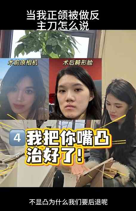 正顎手術丨24歲女做正顎手術反變「鞋抽面」 　醫生死撐：我喜歡這種臉型