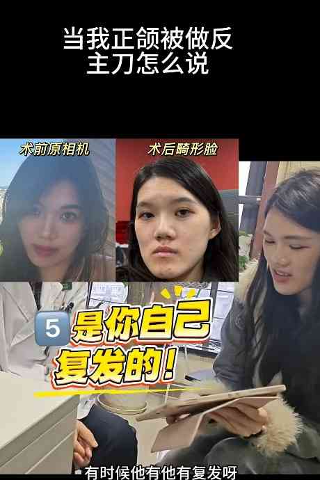 正顎手術丨24歲女做正顎手術反變「鞋抽面」 　醫生死撐：我喜歡這種臉型