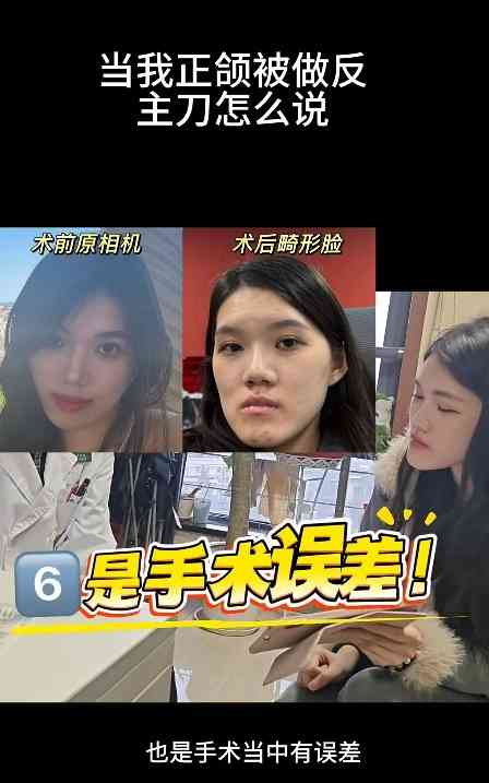 正顎手術丨24歲女做正顎手術反變「鞋抽面」 　醫生死撐：我喜歡這種臉型