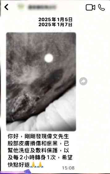 張偉文｜「靚聲王」張偉文疑遭護老院疏忽照顧　傷口潰爛見骨一年半冇沖涼床上痛哭　經理人偕《東張》團隊上門對質