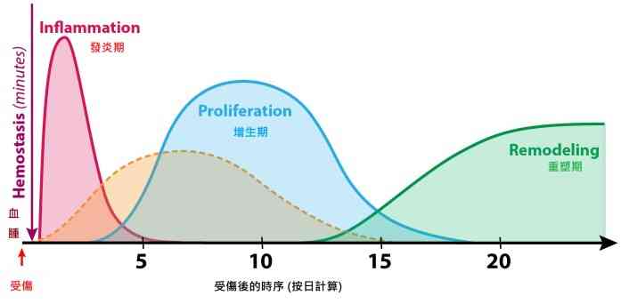 軟組織受傷應該熱敷及按摩「捽鬆」嗎？受傷後四個階段期， H.A.R.M專業建議免加劇惡化