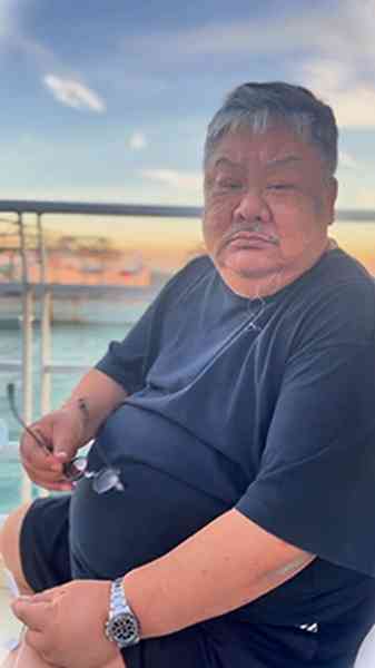明星健康︱61歲林雪臉上驚現巨大黑斑　體重曾達300磅陀巨腩恐藏健康隱憂