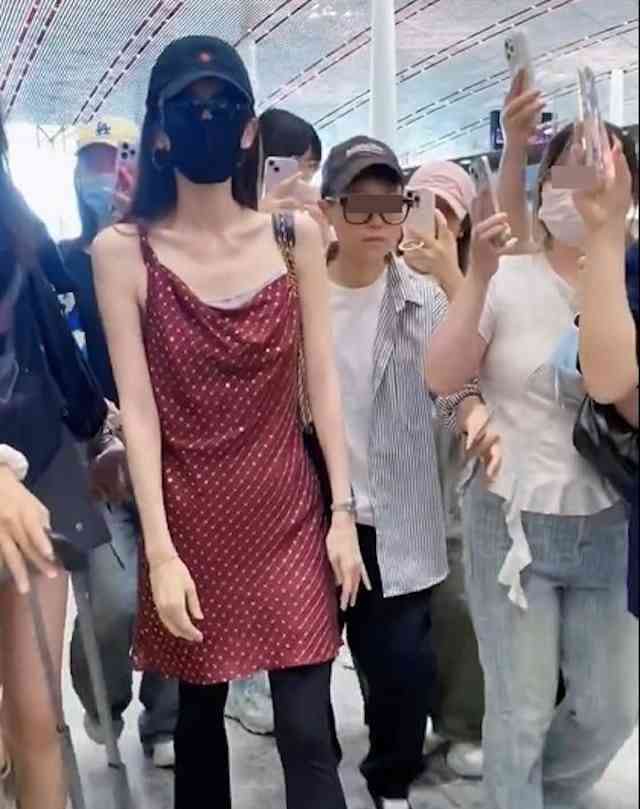 明星健康｜33歲女星暴瘦驚現「排骨胸」紙片身形惹健康憂慮　傳帶葡萄糖傍身防暈倒