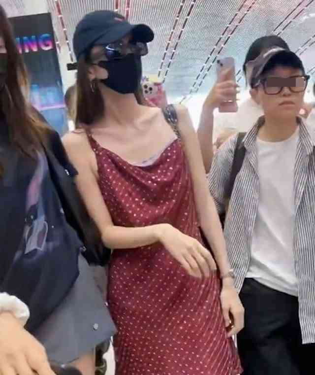 明星健康｜33歲女星暴瘦驚現「排骨胸」紙片身形惹健康憂慮　傳帶葡萄糖傍身防暈倒