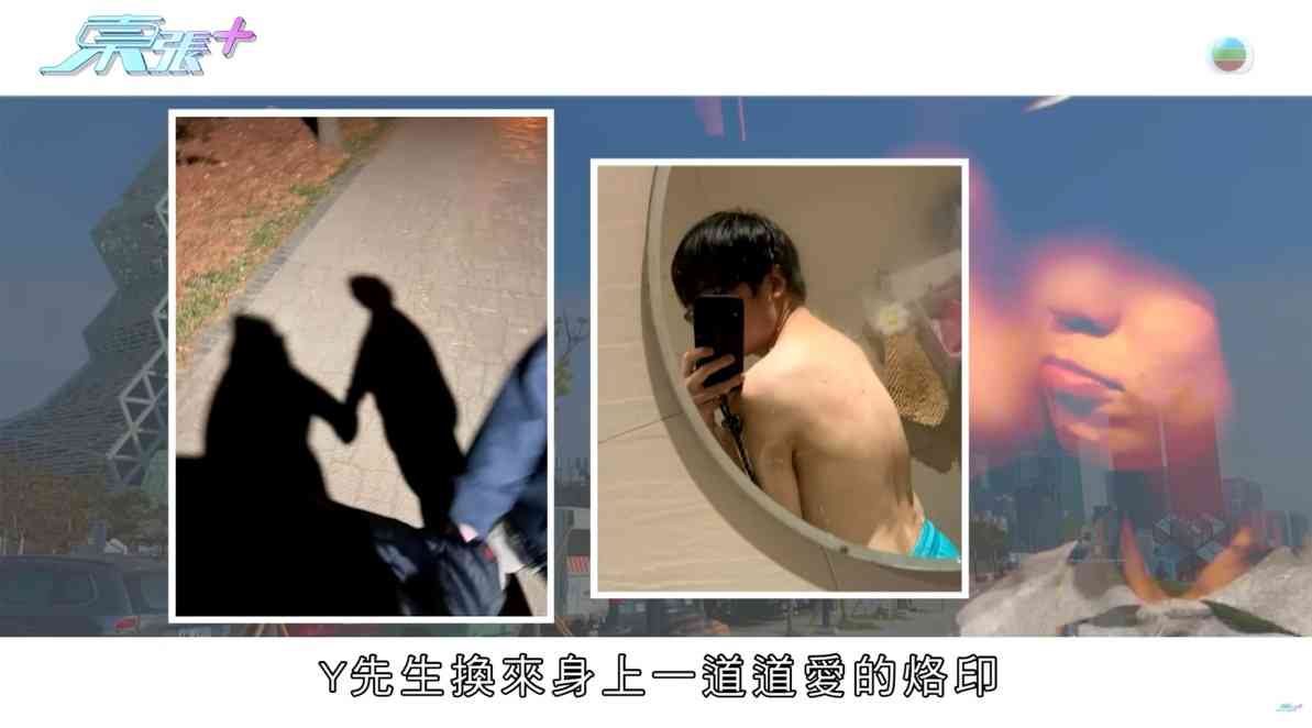 東張西望｜港男交友APP戀上台灣野蠻女友　遭長期虐待患PTSD　屢被掌摑擲鉸剪：摑到耳鳴
