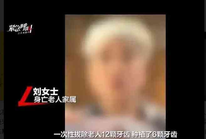 北上剝牙｜一次過剝12隻牙種6隻牙　男子離開診所僅數十分鐘後吐血終不治 -- 健康解「迷」