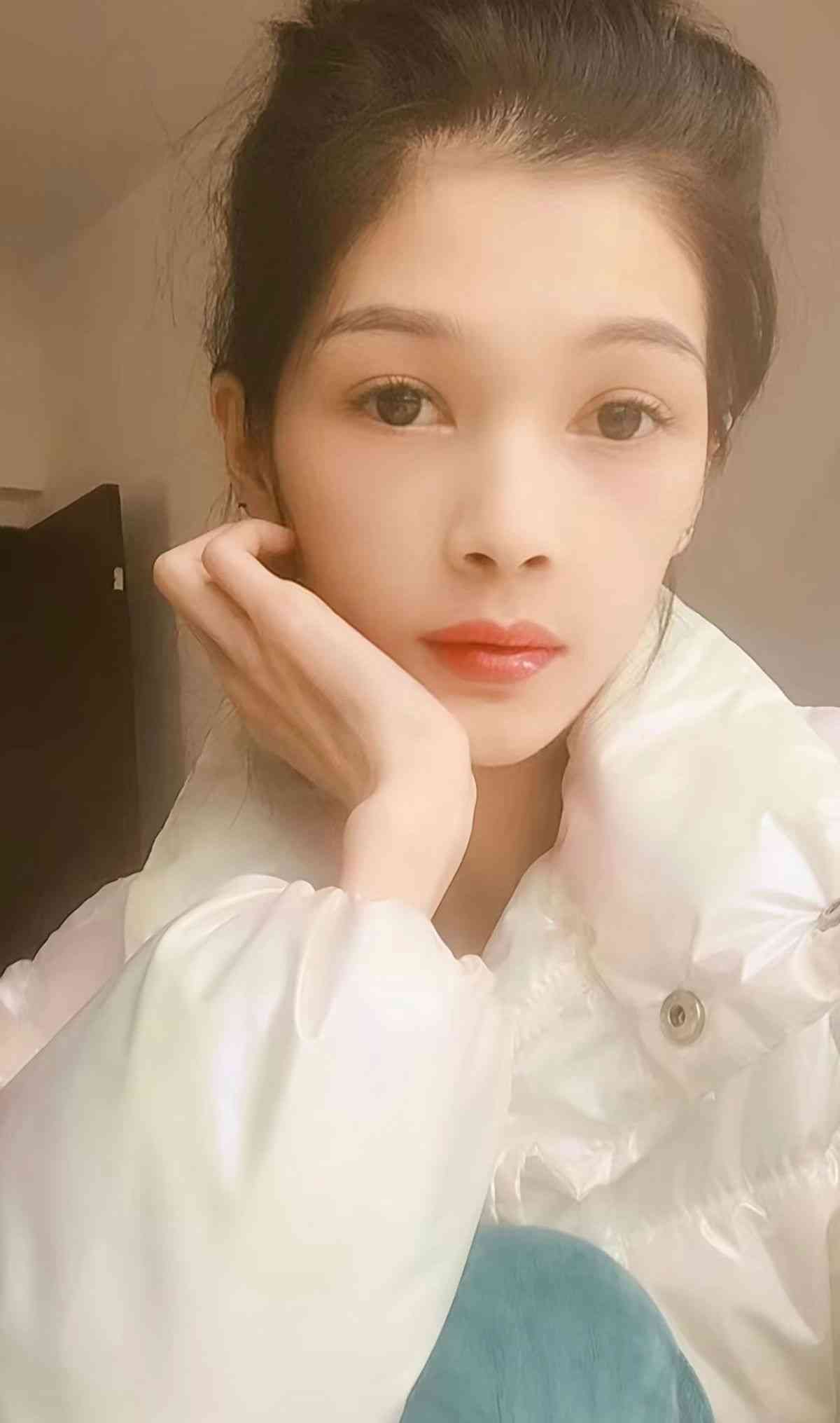 網絡熱話｜27歲女患厭食症體重僅得38磅半　極悲慘身世曝光：我想活下去