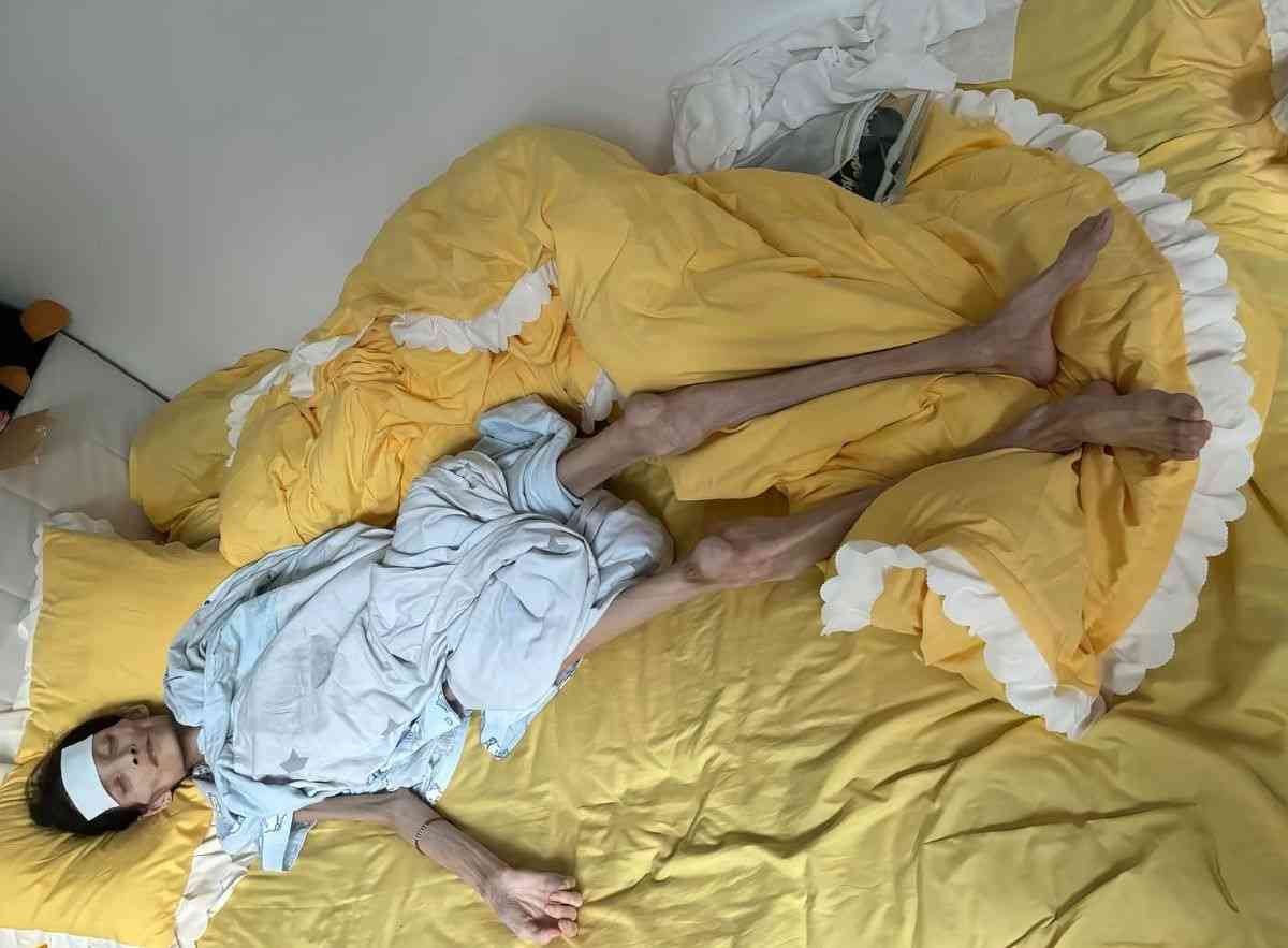網絡熱話｜27歲女患厭食症體重僅得38磅半　極悲慘身世曝光：我想活下去