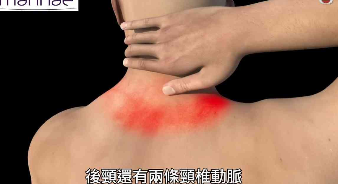 健康新聞報道丨20歲女星泰式按摩lock頸身亡　TVB節目「驗屍」探真相醫生：1個位置絕不能按