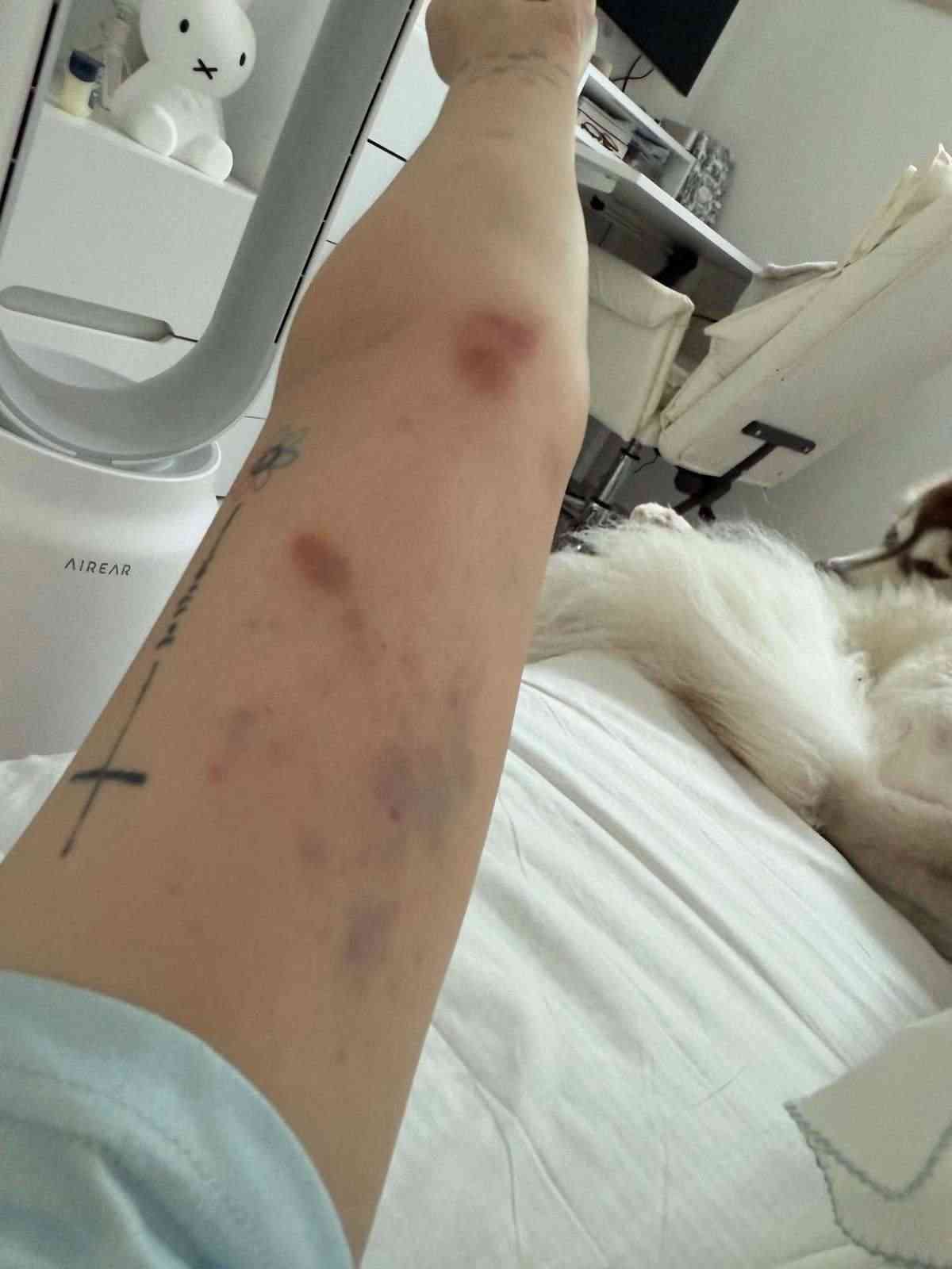 外遊注意｜美女網紅首爾拒搭訕慘遭2陌生男暴打　全身瘀傷兼拇指骨折　韓警處理手法惹熱議