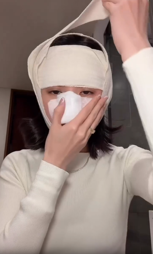 明星保養|裕美首度認整容 公開過程全面針孔極腫 術後3日真面目曝光 明星保養|裕美首度認整容 公開過程全面針孔極腫 術後3日真面目曝光