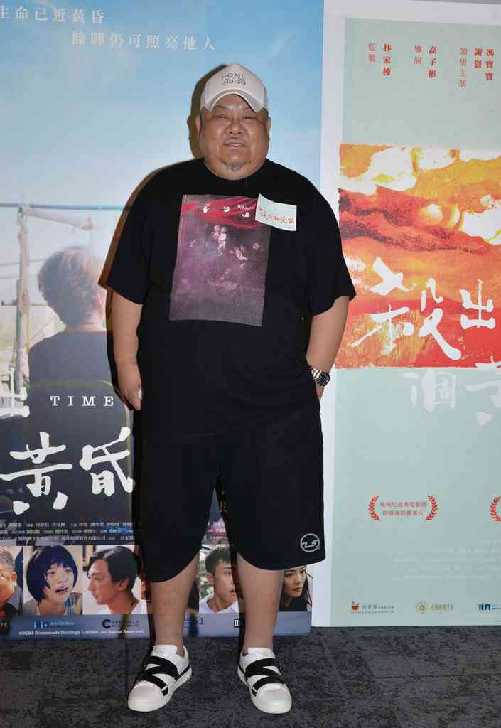 明星健康︱61歲林雪臉上黑斑變大3倍　或與糖尿病及心血管病有關