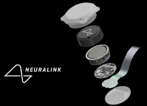 醫療突破︱Neuralink「盲視晶片」直連大腦最快半年內啟動人體植入　馬斯克：先天全盲也能看見