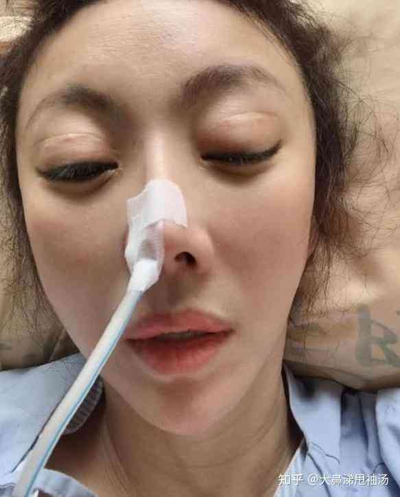 慣性流產｜流產10次為保胎曾活縫子宮　台女星誕罕見病愛子　悉心照顧15年終病逝