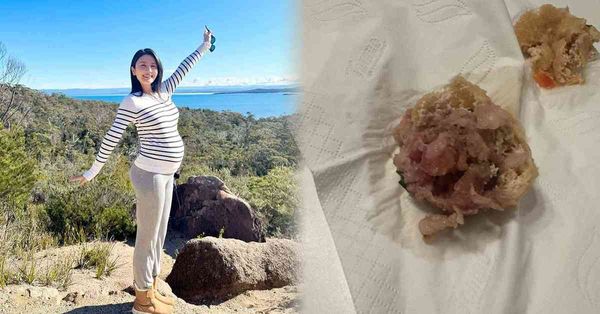 食物安全 │ Coffee林芊妤懷孕32周誤食生豬肉即扣喉，擔心寄生蟲傷害胎兒