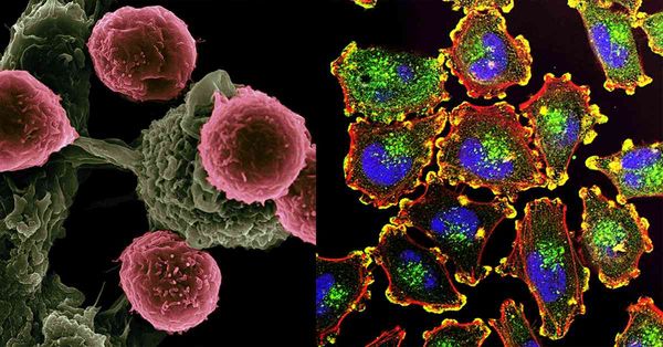 世衛揭6大生活致癌物,1類食物毒素最強!醫生教你10招預防癌...