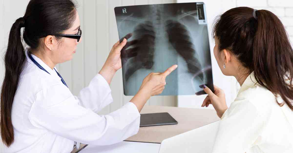 肺癌 │ 60歲婦不煙不酒仍患肺癌，醫生警告：10cm腫瘤可潛伏10年無徵兆