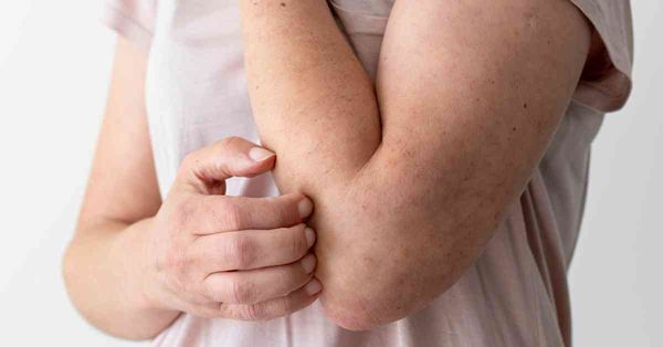 腫瘤權威警告：身體3個部位常痕癢是癌症徵兆，勿誤當濕疹過敏