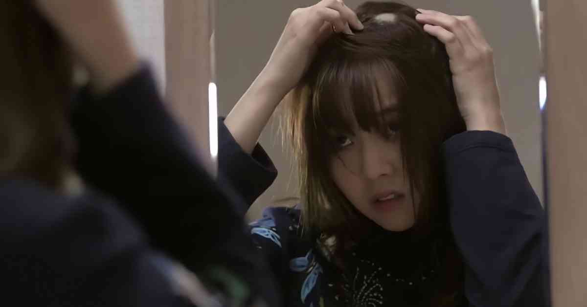 鬼剃頭 │ 研究揭1種蔬菜汁搽頭皮,6星期助87%患者頭髮再生 鬼剃頭 │ 研究揭1種蔬菜汁搽頭皮,6星期助87%患者頭髮再生