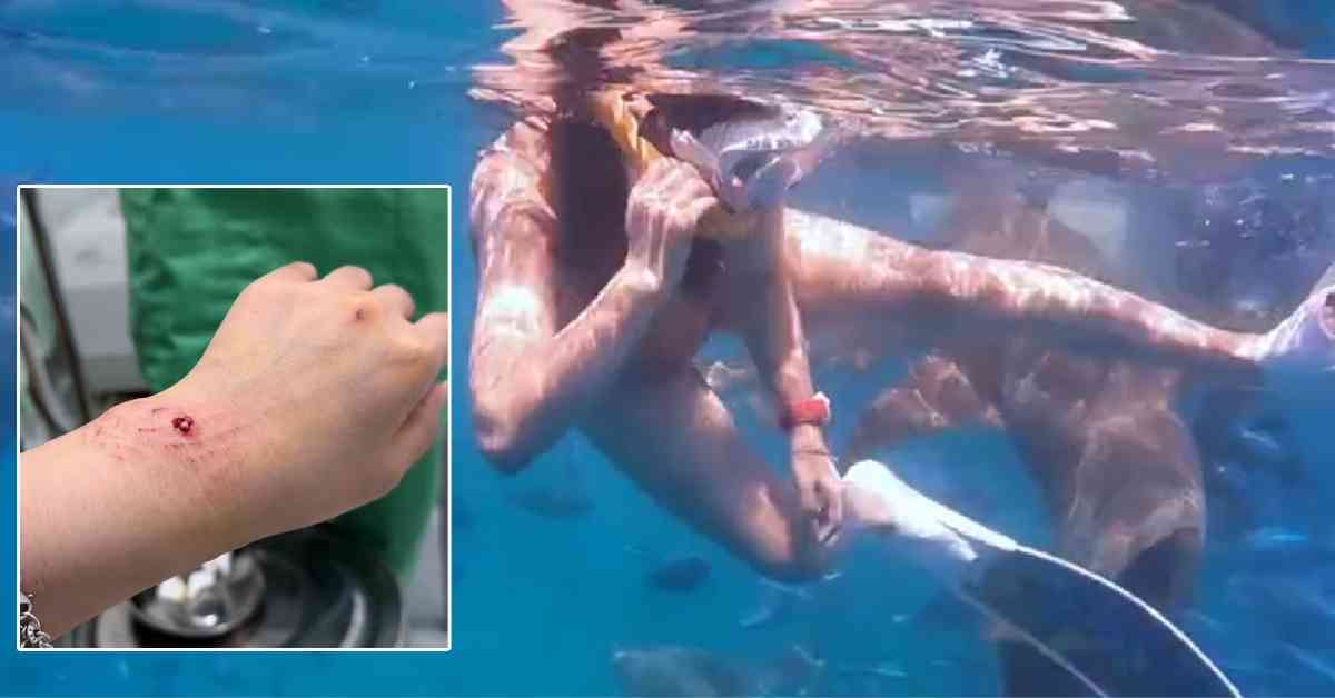 鯊魚襲擊 │ 26歲內地女網紅生理期潛水追鯊魚，拍片打卡遭咬傷