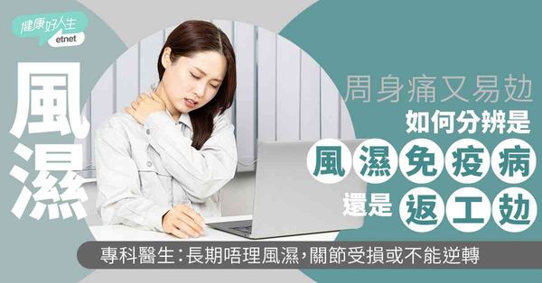 風濕｜周身痛又易攰，如何分辨是風濕免疫病還是「返工攰」？專科醫生：長期唔理風濕，關節受損可以不能逆轉