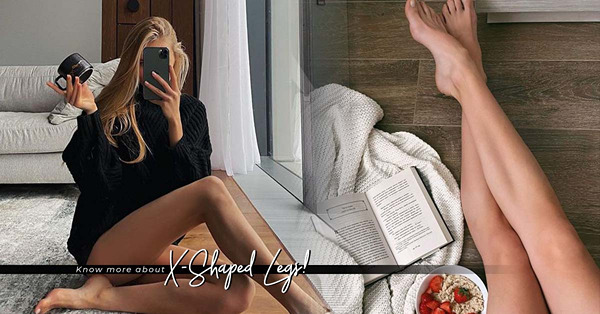 X形腿讓女生缺乏氣質，還可能影響身型、生活！你有這個問題嗎？用3個方法測試！ 先看自己有否扁平足、八字腳、髖關節內旋！